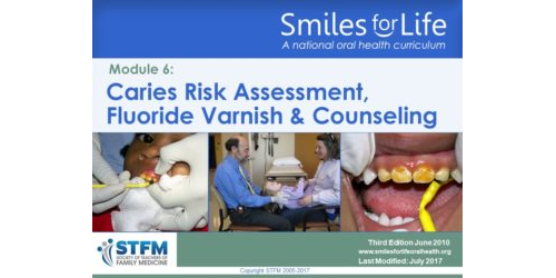 Download Slides – Module 6: Fluoride Varnish | Smiles For Life Oral Health